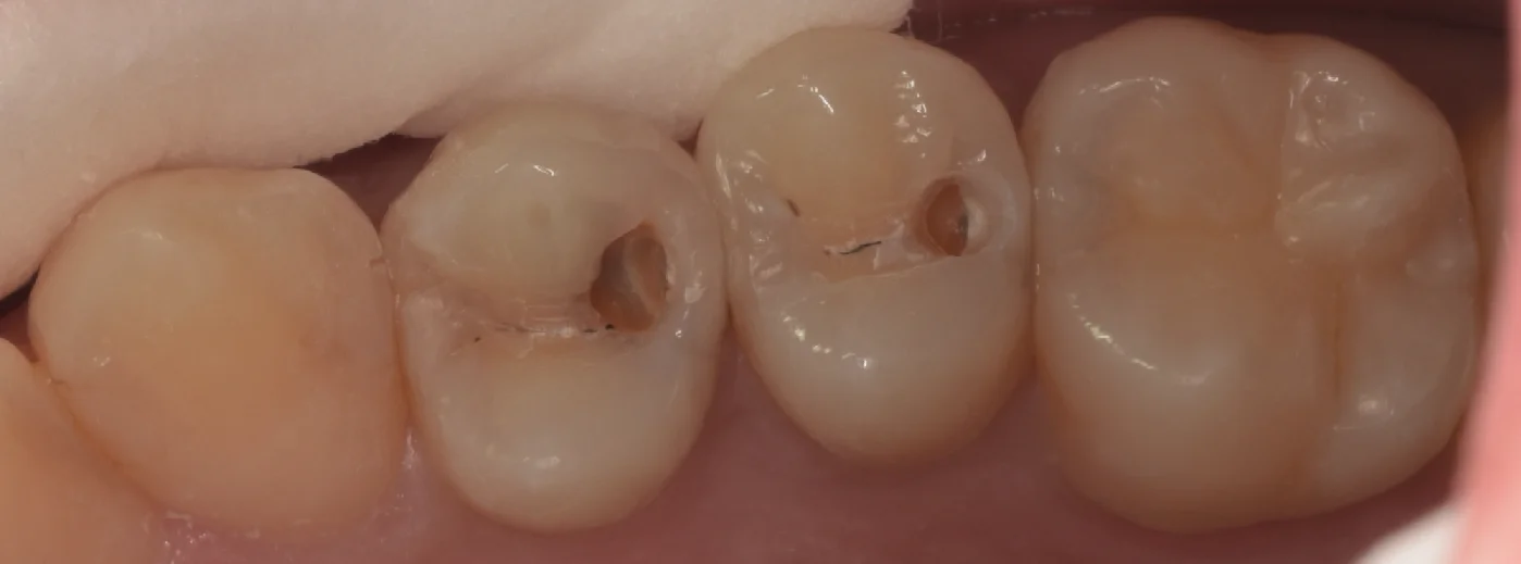 通常の保険診療。｜坂寄歯科医院（取手市藤代） - 画像2