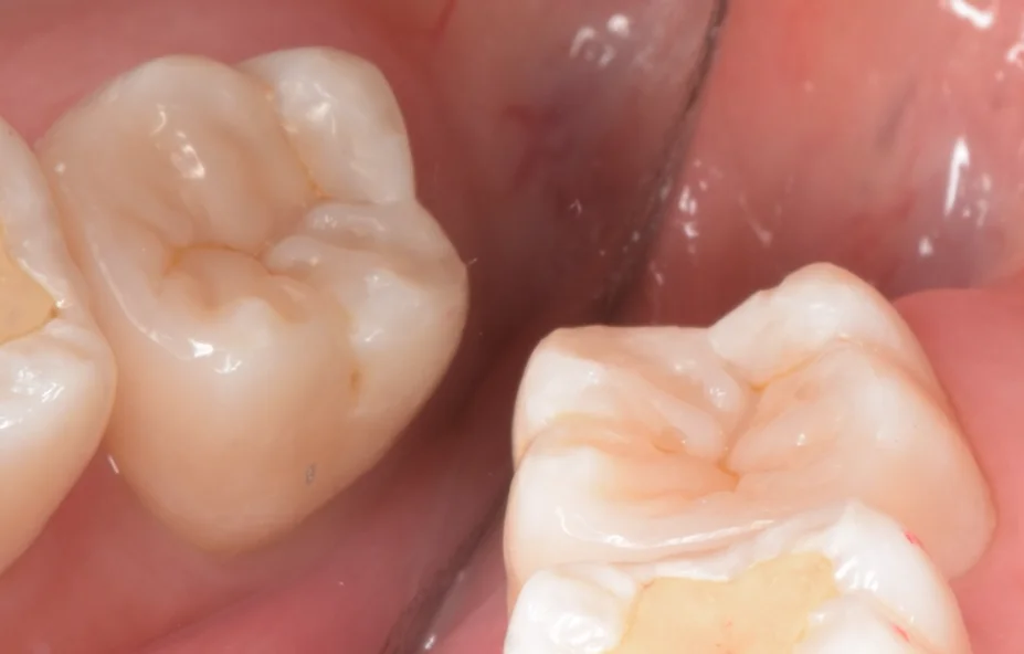 足立区からお越しの方。｜坂寄歯科医院（取手市藤代） - 画像9