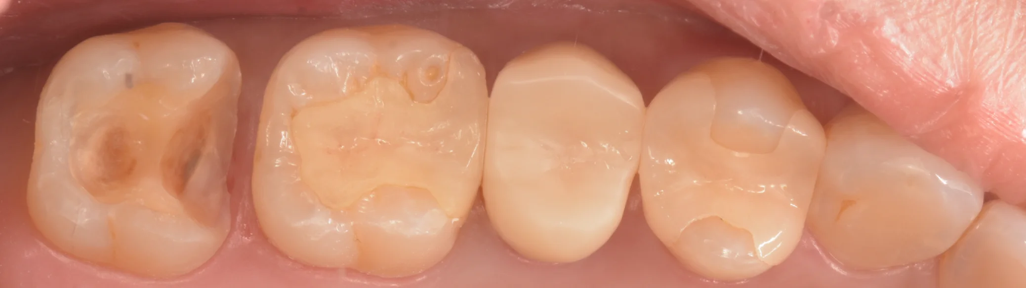 足立区からお越しの方。｜坂寄歯科医院（取手市藤代） - 画像3