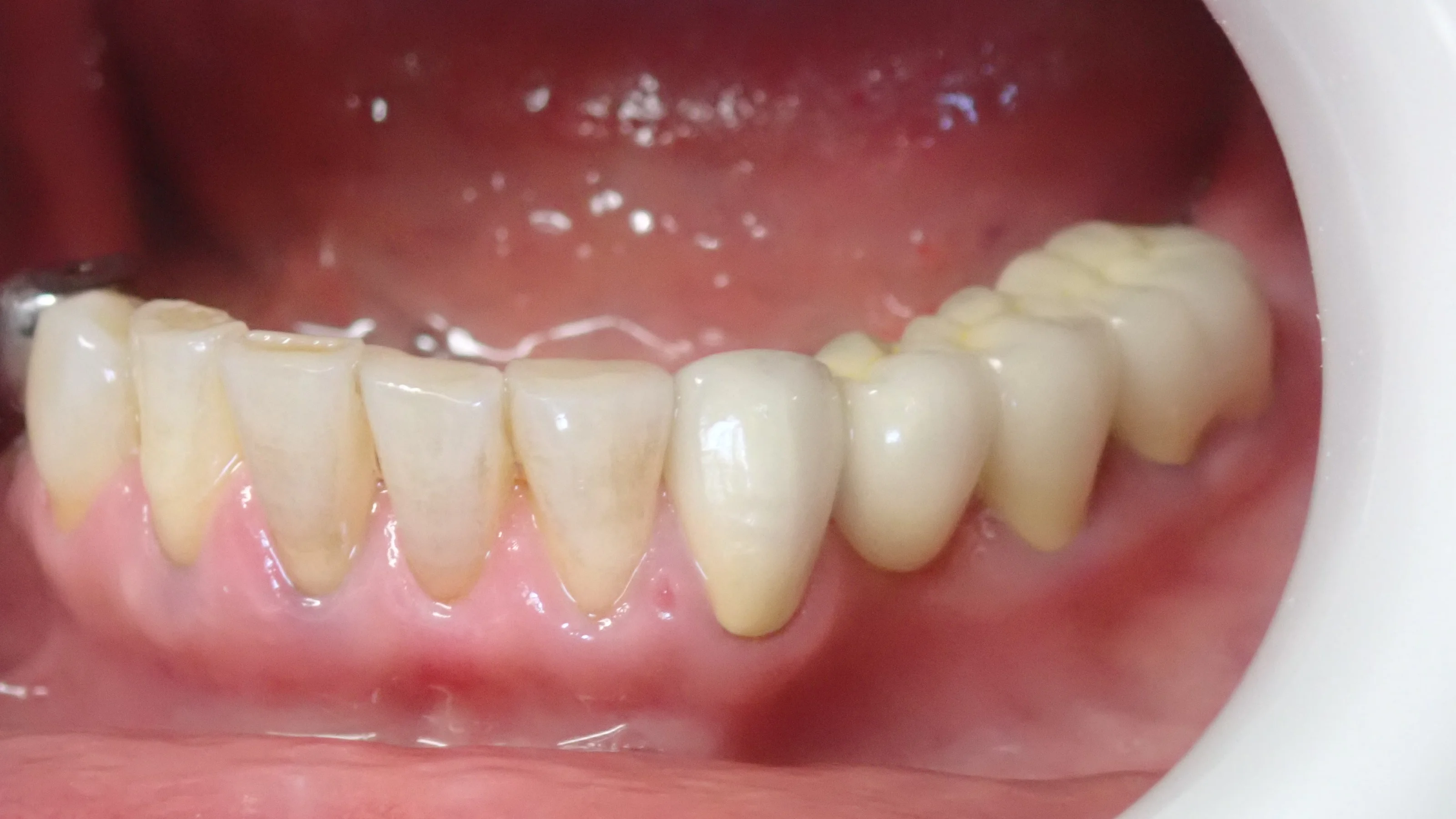 ブログ・お役立ち情報｜坂寄歯科医院（取手市藤代）