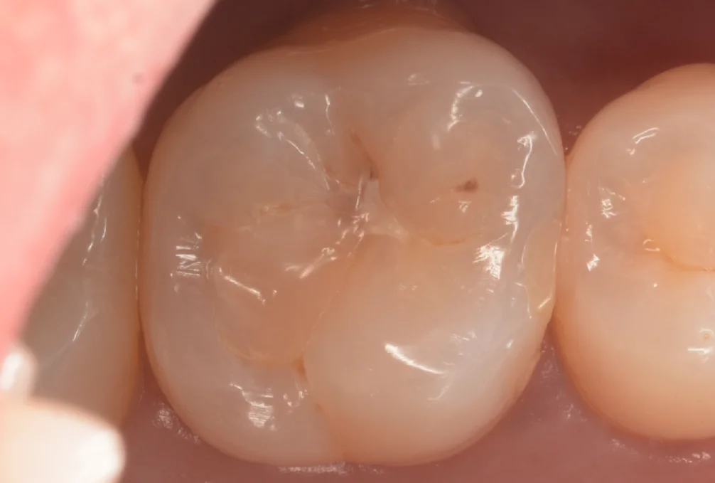 ブログ・お役立ち情報｜坂寄歯科医院（取手市藤代）