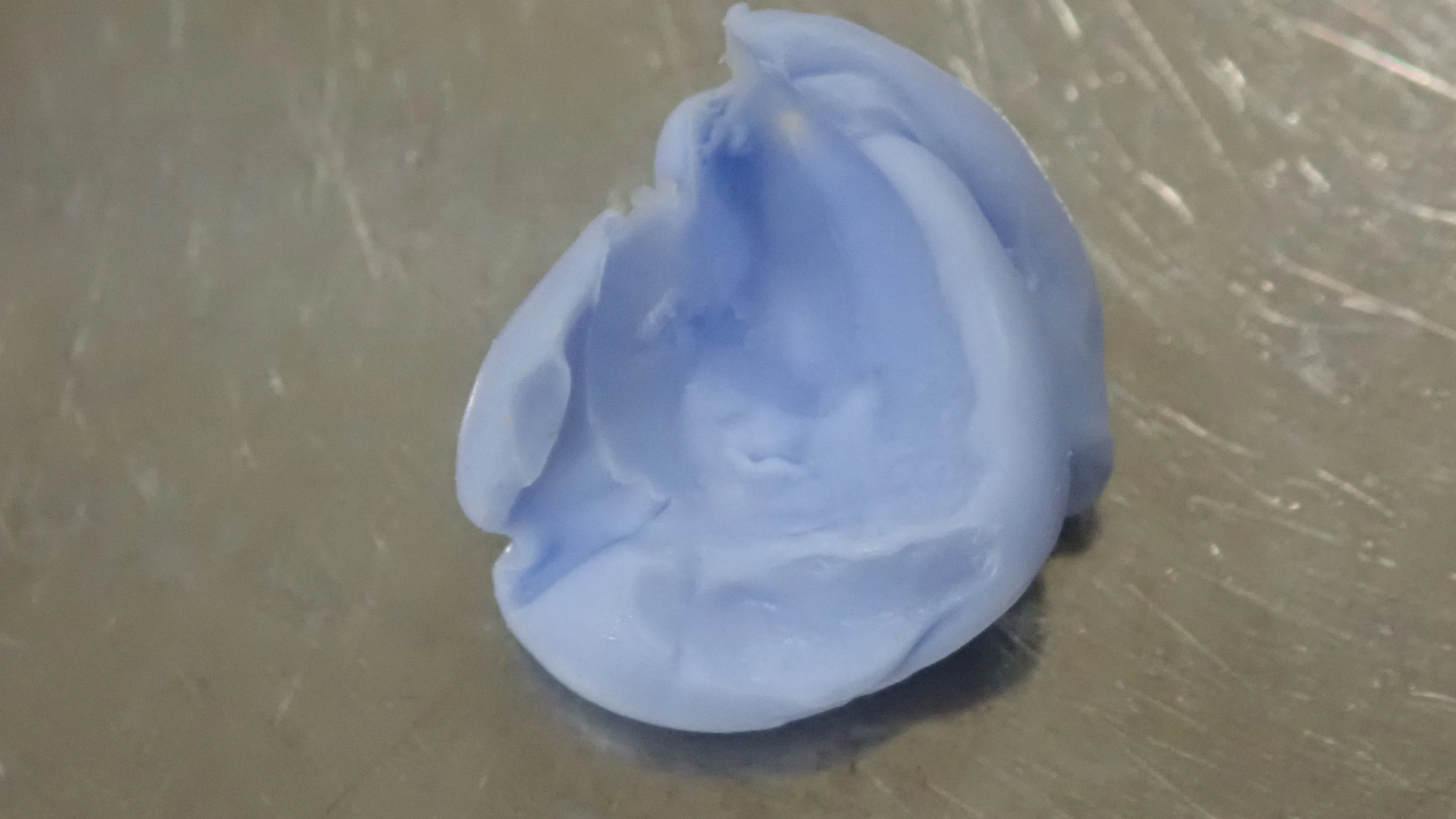 右上犬歯の白い詰め物｜坂寄歯科医院（取手市藤代） - 画像4