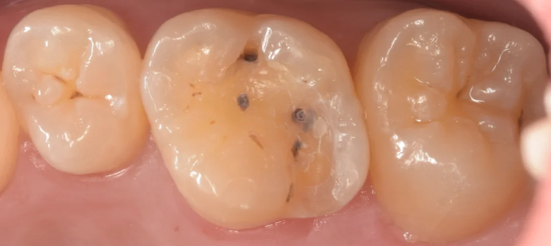 竜ヶ崎市からお越しの方。｜坂寄歯科医院（取手市藤代） - 画像2