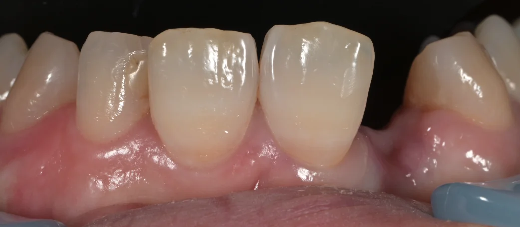 ブログ・お役立ち情報｜坂寄歯科医院（取手市藤代）