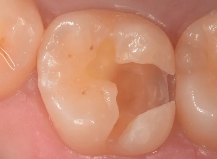 浦安からお越しの方。｜坂寄歯科医院（取手市藤代） - 画像6