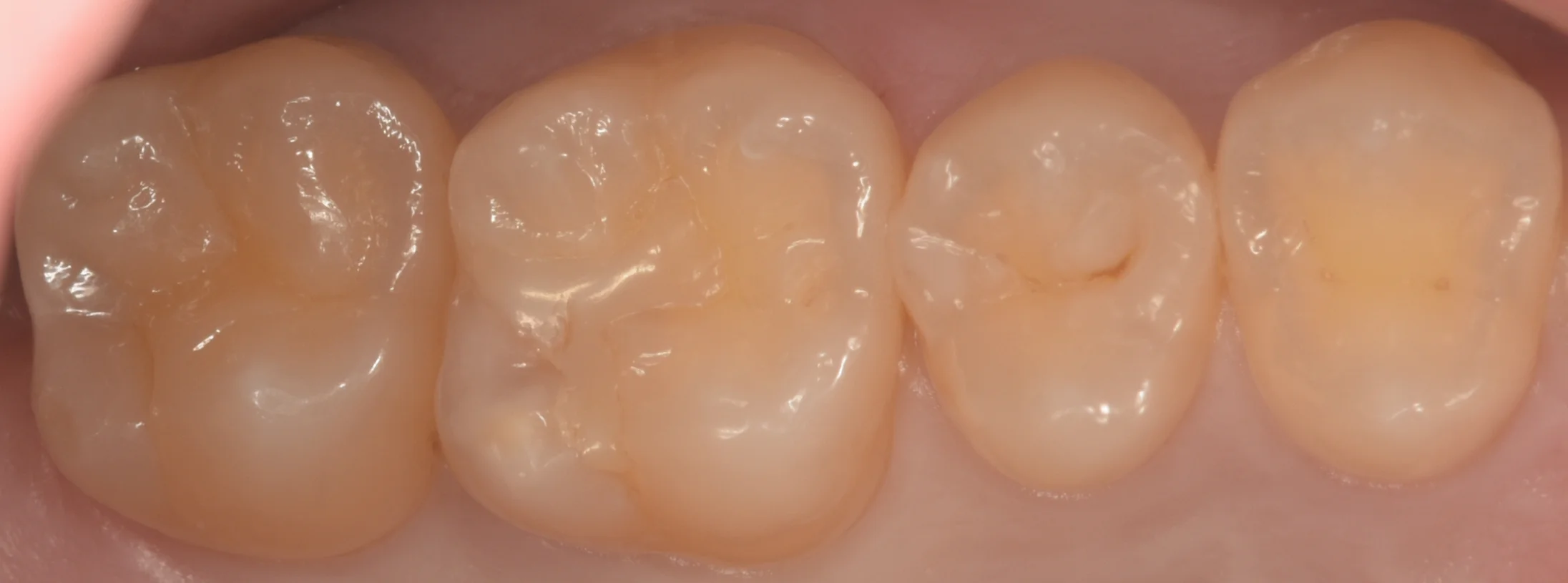 ブログ・お役立ち情報｜坂寄歯科医院（取手市藤代）