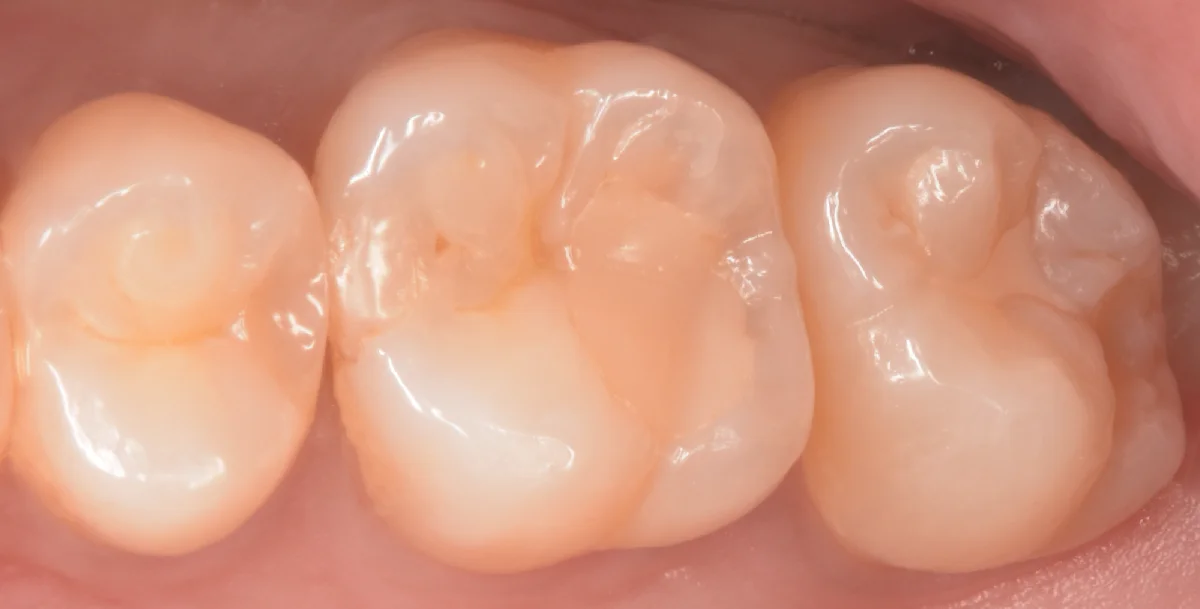 ブログ・お役立ち情報｜坂寄歯科医院（取手市藤代）