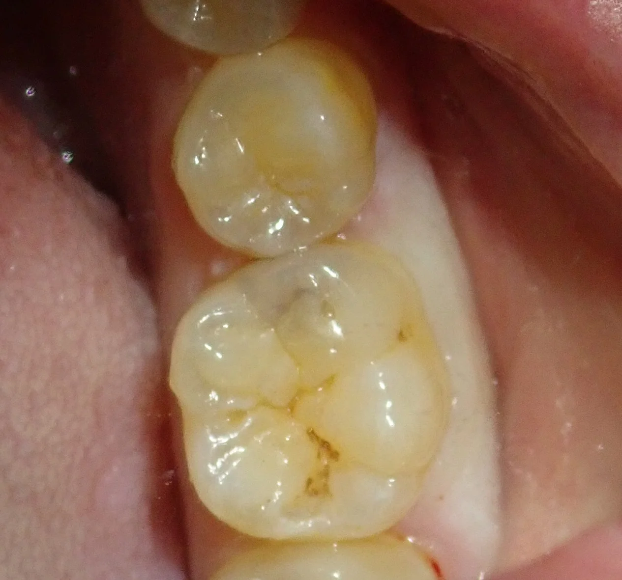 ブログ・お役立ち情報｜坂寄歯科医院（取手市藤代）