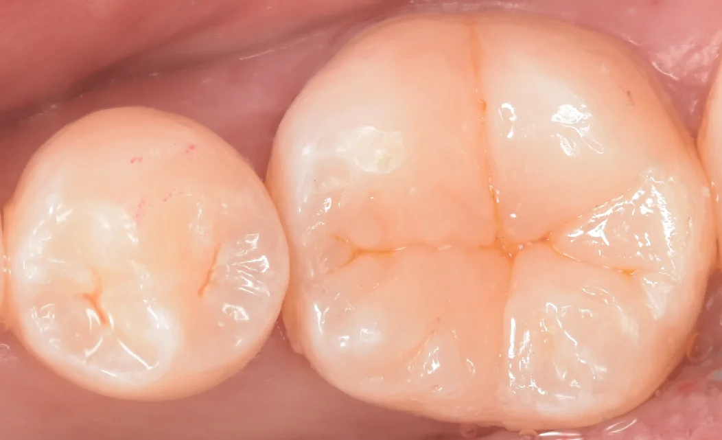 印西からお越しの方｜坂寄歯科医院（取手市藤代） - 画像5