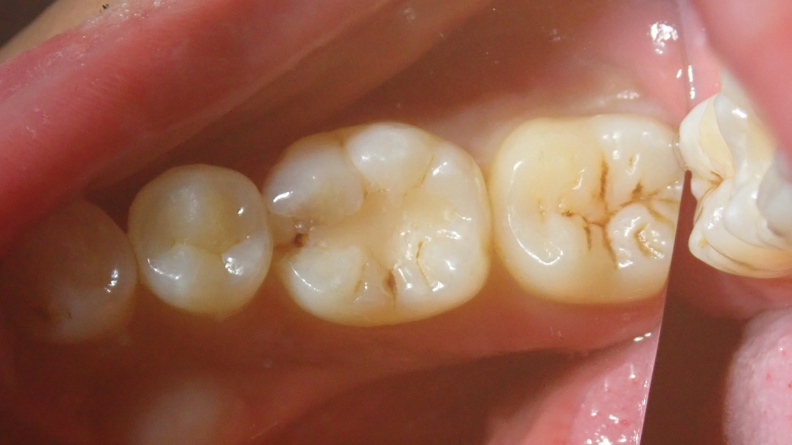ブログ・お役立ち情報｜坂寄歯科医院（取手市藤代）