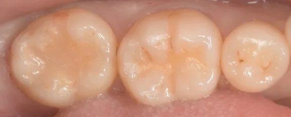 ブログ・お役立ち情報｜坂寄歯科医院（取手市藤代）