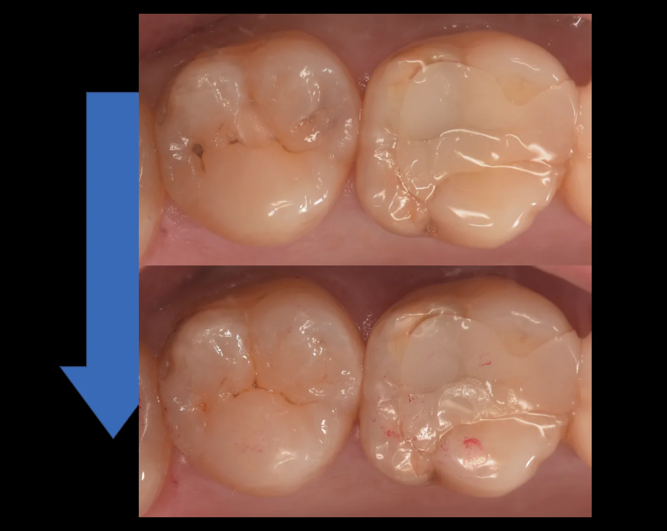 他県より来院された方。｜坂寄歯科医院（取手市藤代） - 画像5