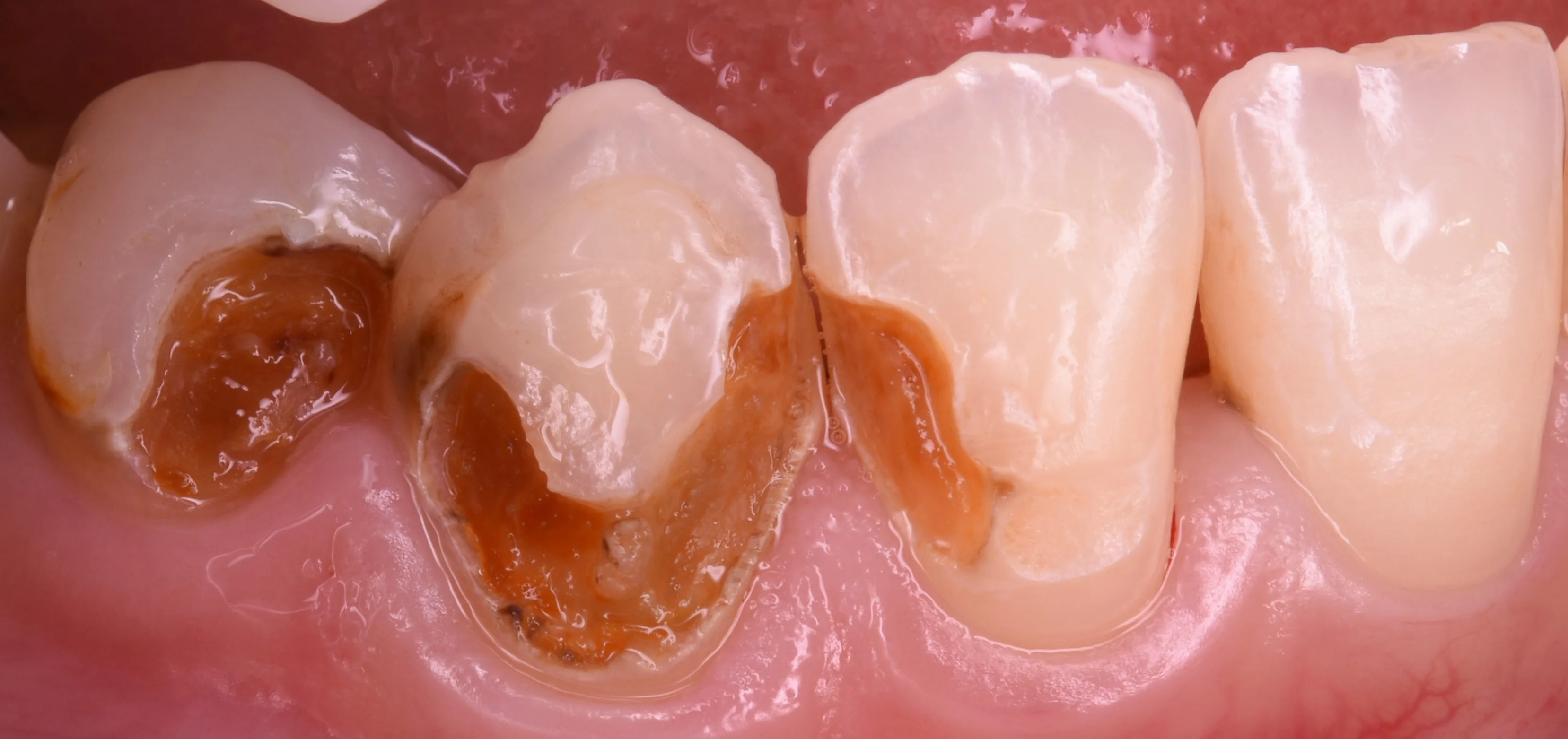 ブログ・お役立ち情報｜坂寄歯科医院（取手市藤代）