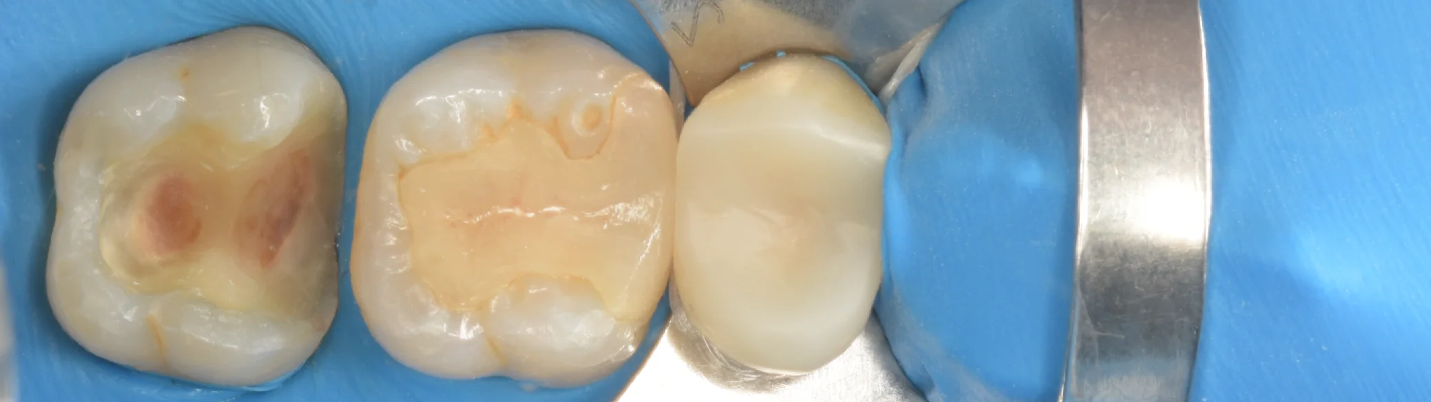 足立区からお越しの方。｜坂寄歯科医院（取手市藤代） - 画像4