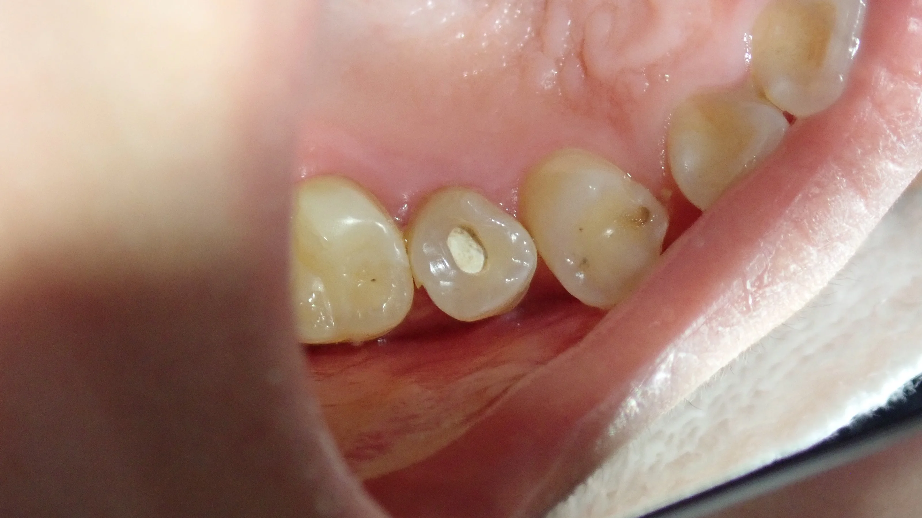 ブログ・お役立ち情報｜坂寄歯科医院（取手市藤代）
