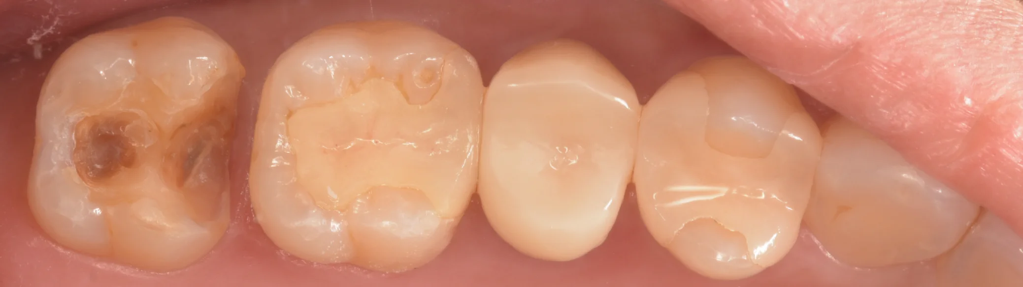 足立区からお越しの方。｜坂寄歯科医院（取手市藤代） - 画像2