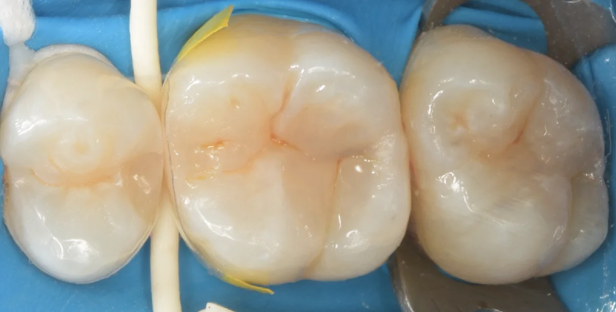 印西市からお越しの方。｜坂寄歯科医院（取手市藤代） - 画像3