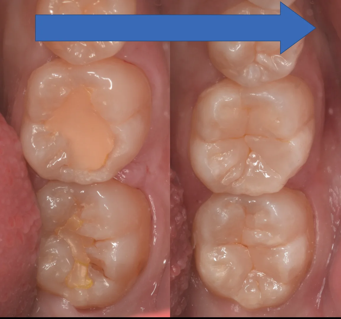 竜ヶ崎市からお越しの方。｜坂寄歯科医院（取手市藤代） - 画像5