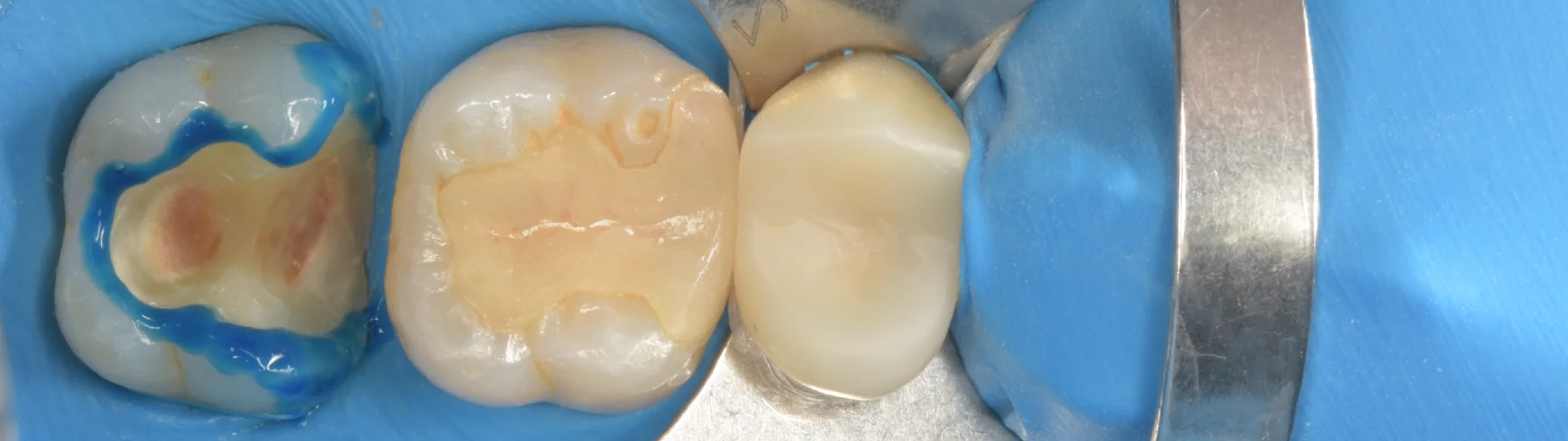 足立区からお越しの方。｜坂寄歯科医院（取手市藤代） - 画像5