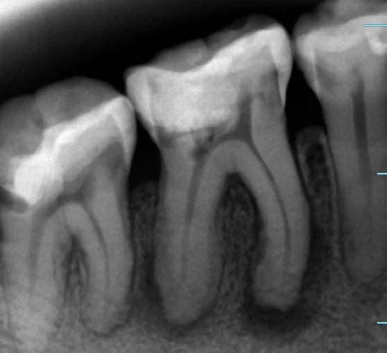 ブログ・お役立ち情報｜坂寄歯科医院（取手市藤代）