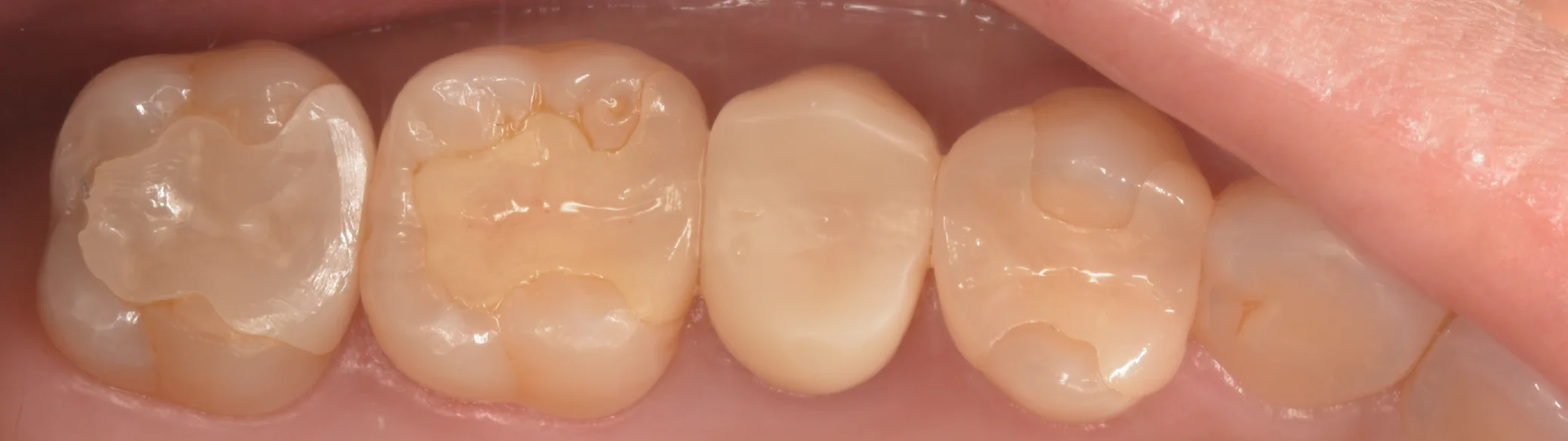 ブログ・お役立ち情報｜坂寄歯科医院（取手市藤代）