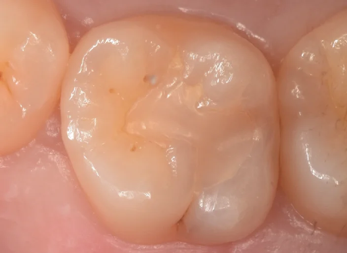 浦安からお越しの方。｜坂寄歯科医院（取手市藤代） - 画像4