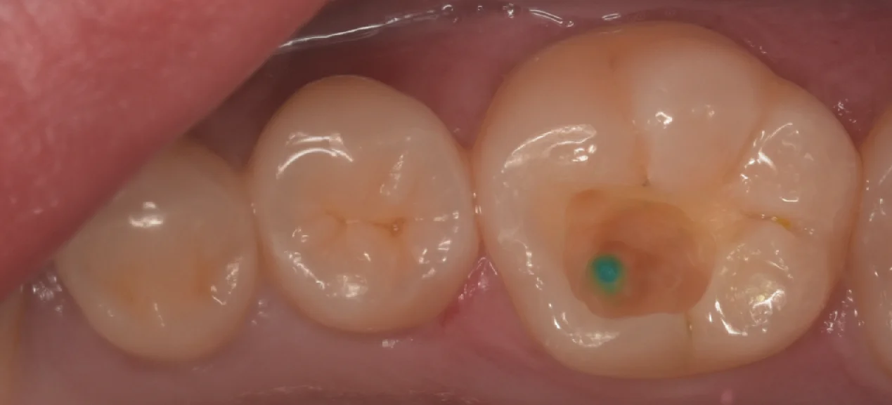 歯学部生をダイレクトで。｜坂寄歯科医院（取手市藤代） - 画像3