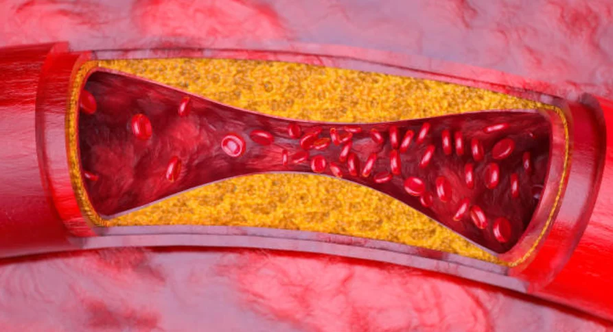 神経の治療⑤｜坂寄歯科医院（取手市藤代） - 画像2