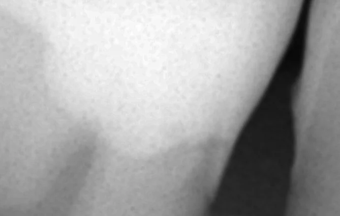 難易度の高い白い詰め物。｜坂寄歯科医院（取手市藤代） - 画像7