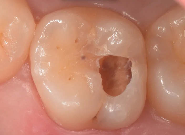 浦安からお越しの方。｜坂寄歯科医院（取手市藤代） - 画像5