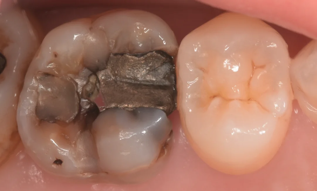 ブログ・お役立ち情報｜坂寄歯科医院（取手市藤代）