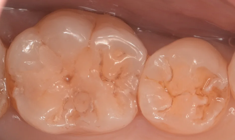 神奈川県からお越しの方｜坂寄歯科医院（取手市藤代） - 画像3