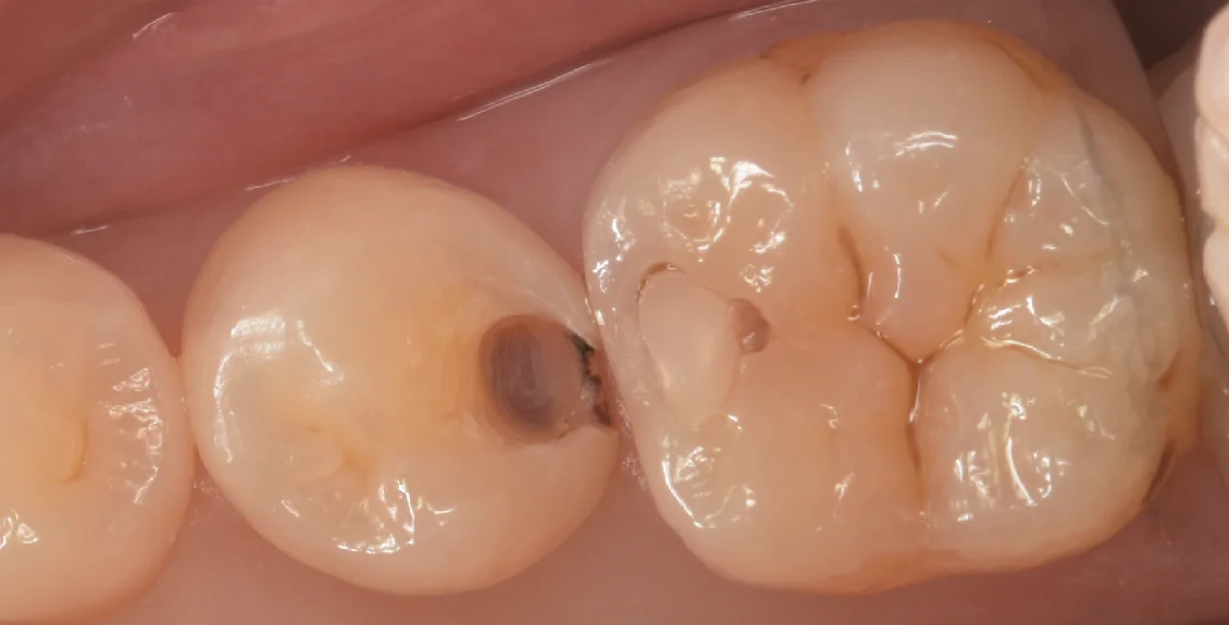 東京都内よりお越しの方をダイレクトで。｜坂寄歯科医院（取手市藤代） - 画像2