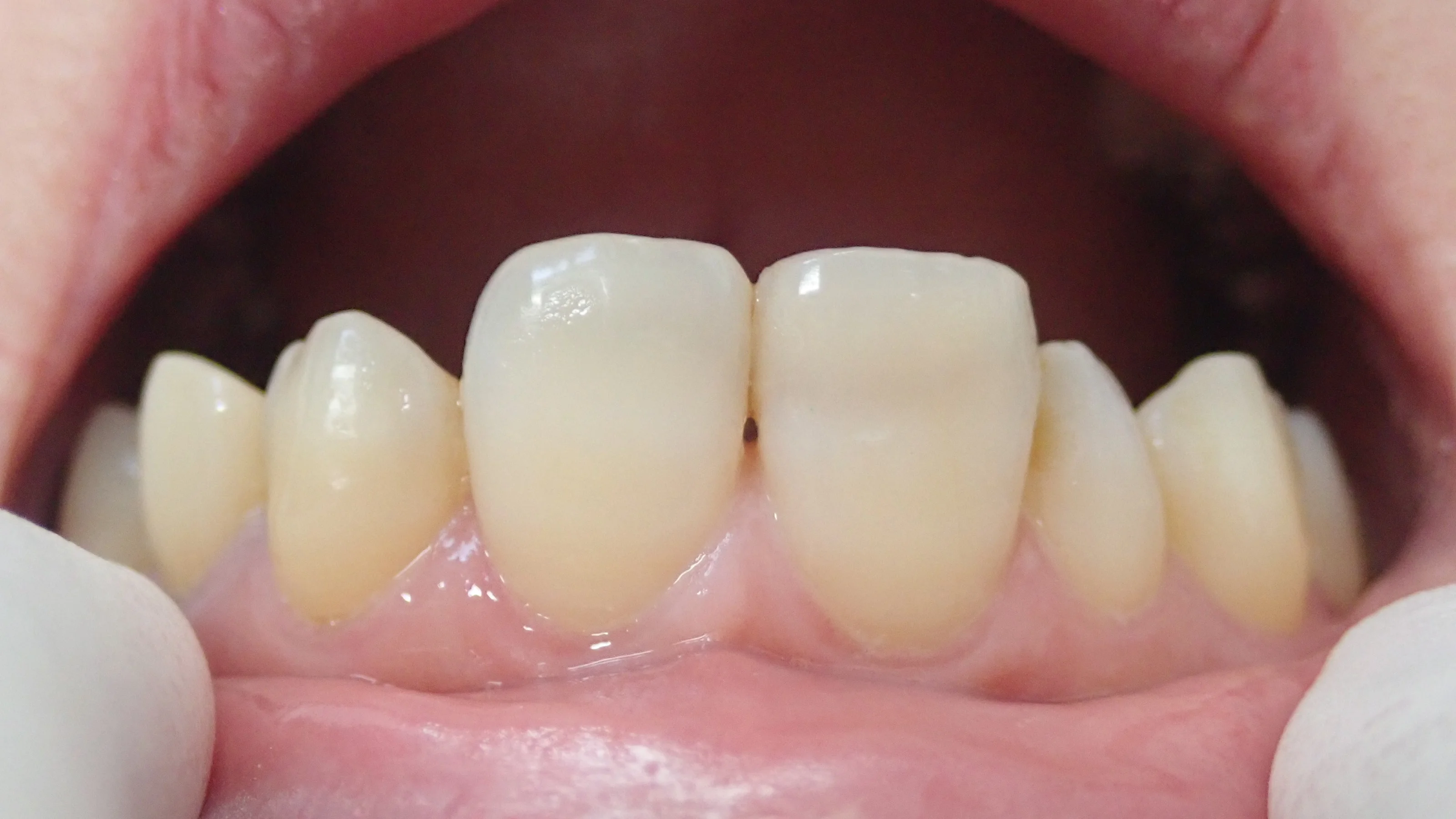 ブログ・お役立ち情報｜坂寄歯科医院（取手市藤代）