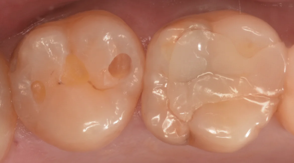 他県より来院された方。｜坂寄歯科医院（取手市藤代） - 画像3