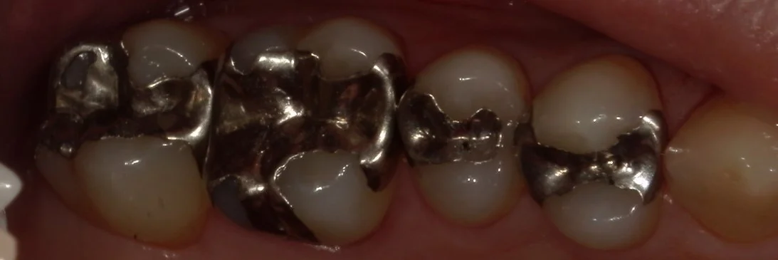 ブログ・お役立ち情報｜坂寄歯科医院（取手市藤代）