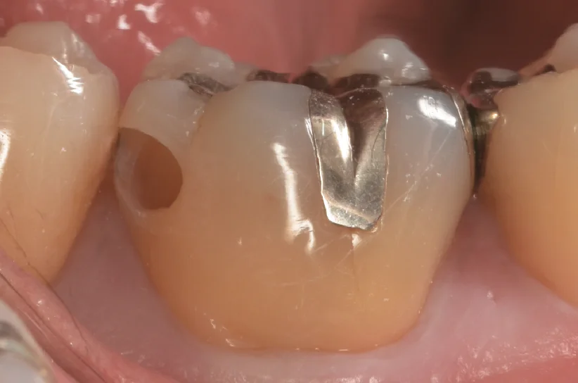 栃木県からお越しの方。｜坂寄歯科医院（取手市藤代） - 画像3