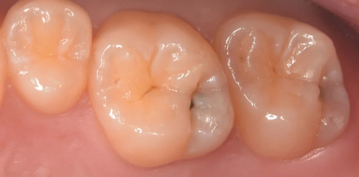ブログ・お役立ち情報｜坂寄歯科医院（取手市藤代）