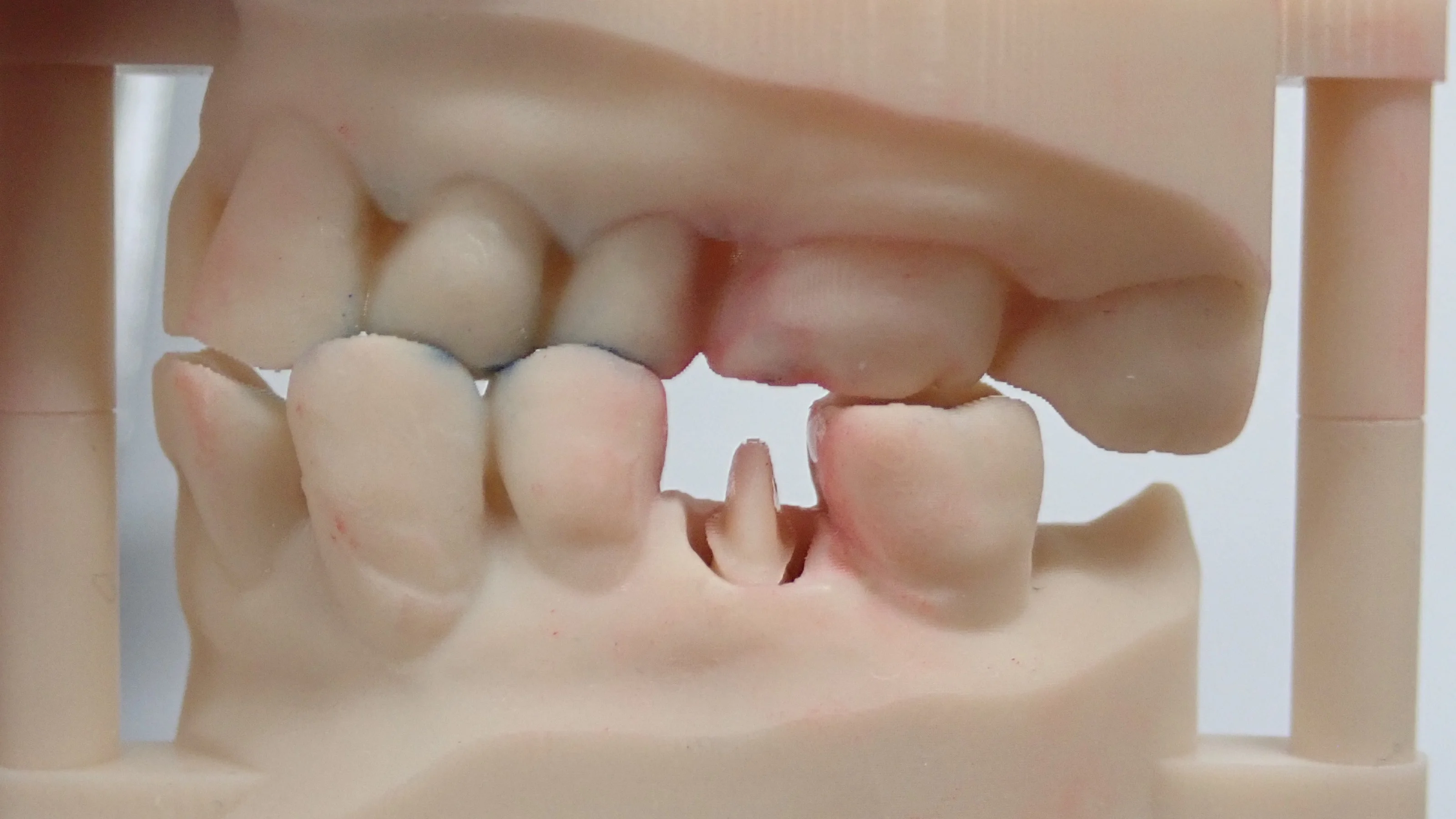 ブログ・お役立ち情報｜坂寄歯科医院（取手市藤代）