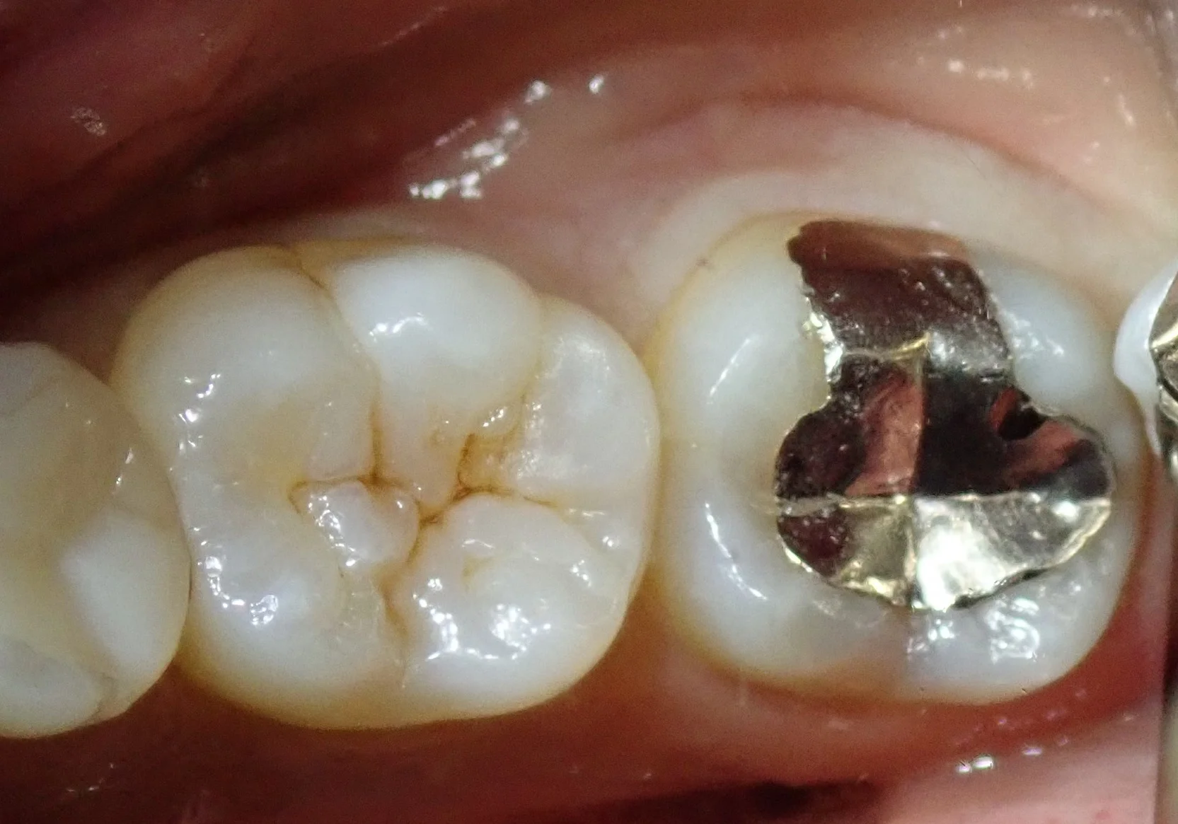 ブログ・お役立ち情報｜坂寄歯科医院（取手市藤代）