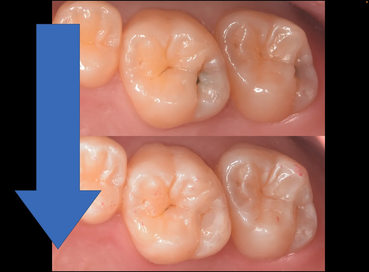 群馬からお越しの歯科医師の方。｜坂寄歯科医院（取手市藤代） - 画像5