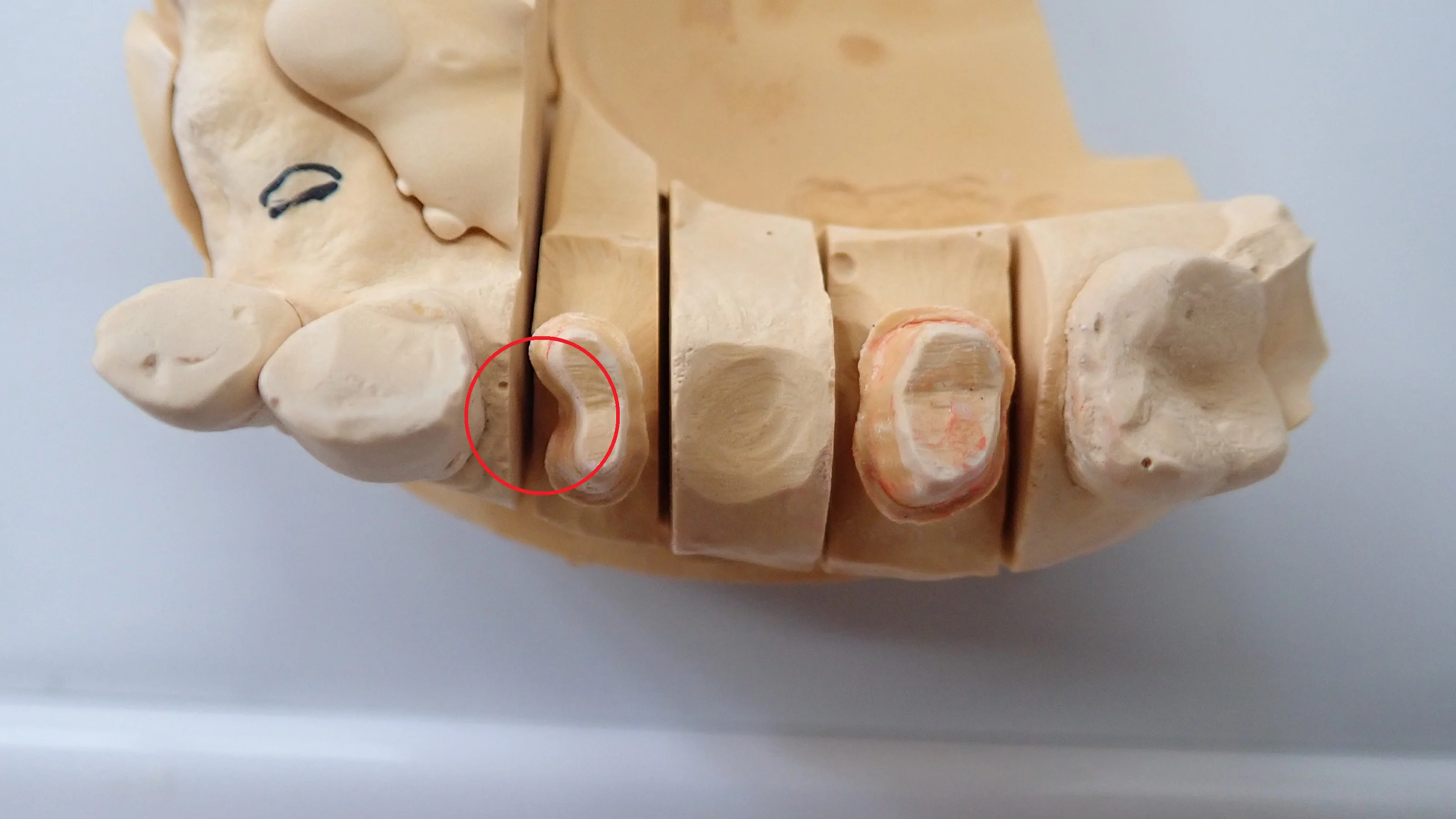 ブログ・お役立ち情報｜坂寄歯科医院（取手市藤代）