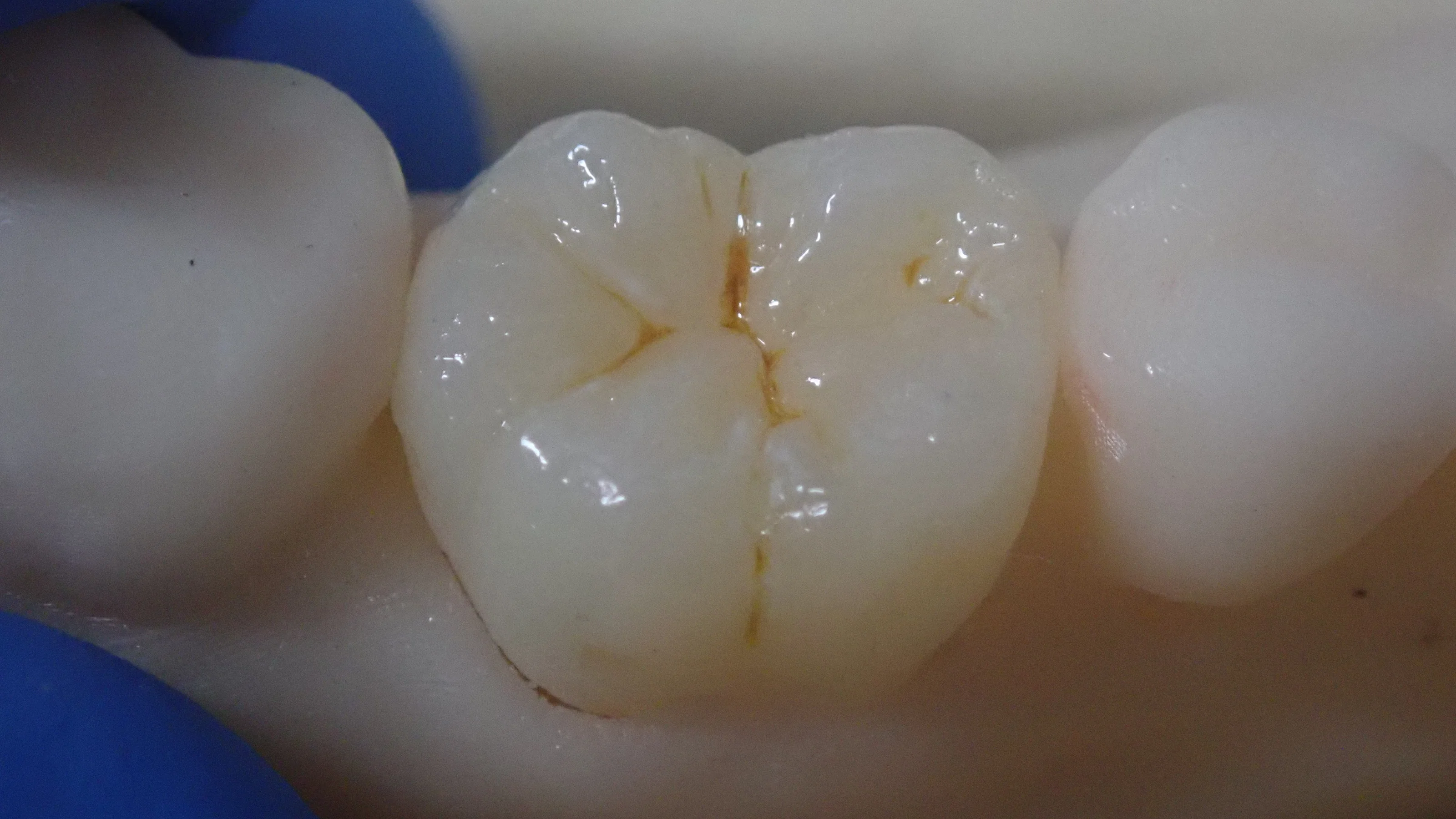 解剖学的知識を深め、更に治療精度を高めるために･･･｜坂寄歯科医院（取手市藤代） - 画像3