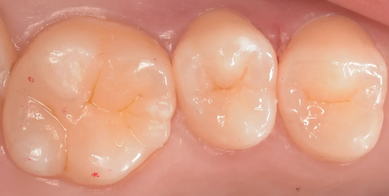 夢の国近辺から通院中の方。｜坂寄歯科医院（取手市藤代） - 画像4