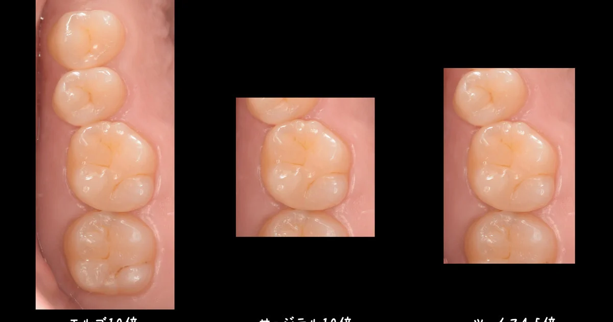 ブログ・お役立ち情報｜坂寄歯科医院（取手市藤代）