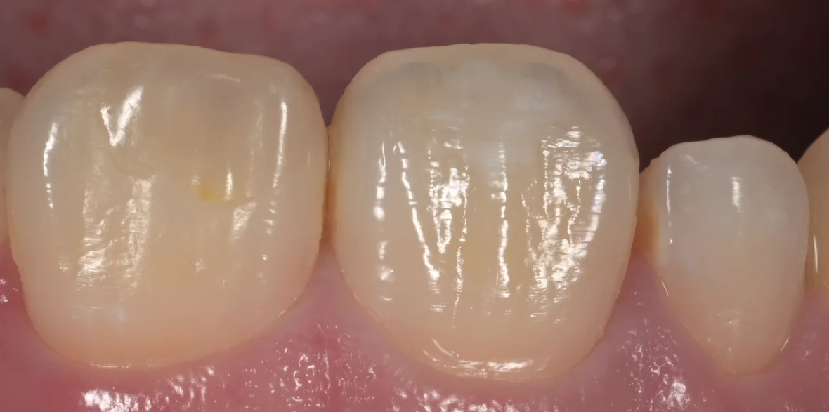 ブログ・お役立ち情報｜坂寄歯科医院（取手市藤代）