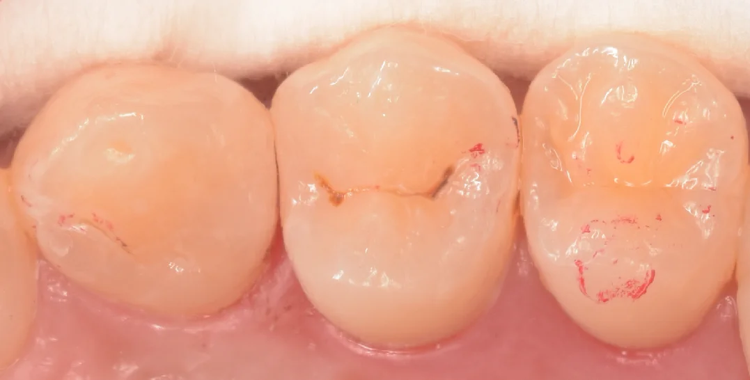 千葉からお越しの歯科衛生士さん。｜坂寄歯科医院（取手市藤代） - 画像4