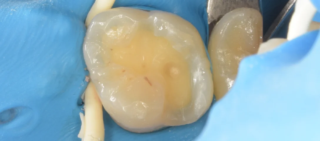 竜ヶ崎市からお越しの方。｜坂寄歯科医院（取手市藤代） - 画像3