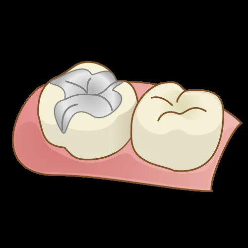 歯を可及的に温存したブリッジ｜坂寄歯科医院（取手市藤代） - 画像2