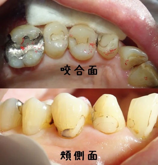 ブログ・お役立ち情報｜坂寄歯科医院（取手市藤代）
